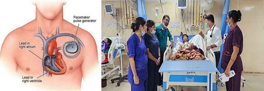 छत्तीसगढ़-जगदलपुर में डॉक्टरों ने युवक को सीने में दर्द पर दिल में लगाया पेसमेकर
